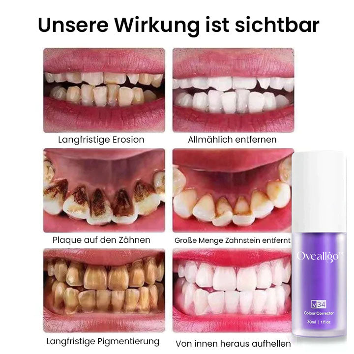 DermaLux™ Rein pflanzliches Zahnweiß-Mousse